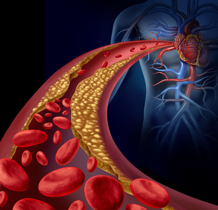 The Secrets to Lowering Your Cholesterol