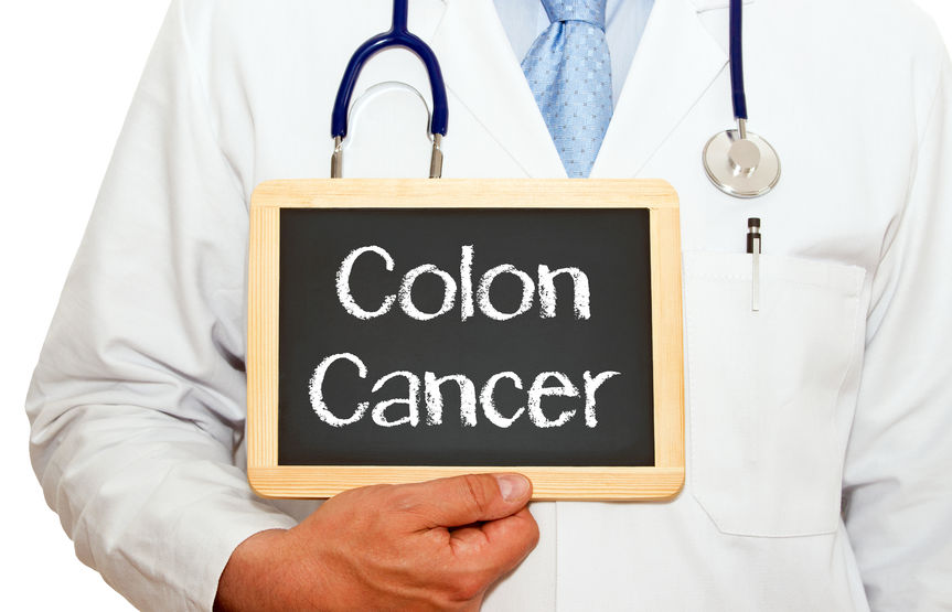 colon cancer prevention colonoscopy