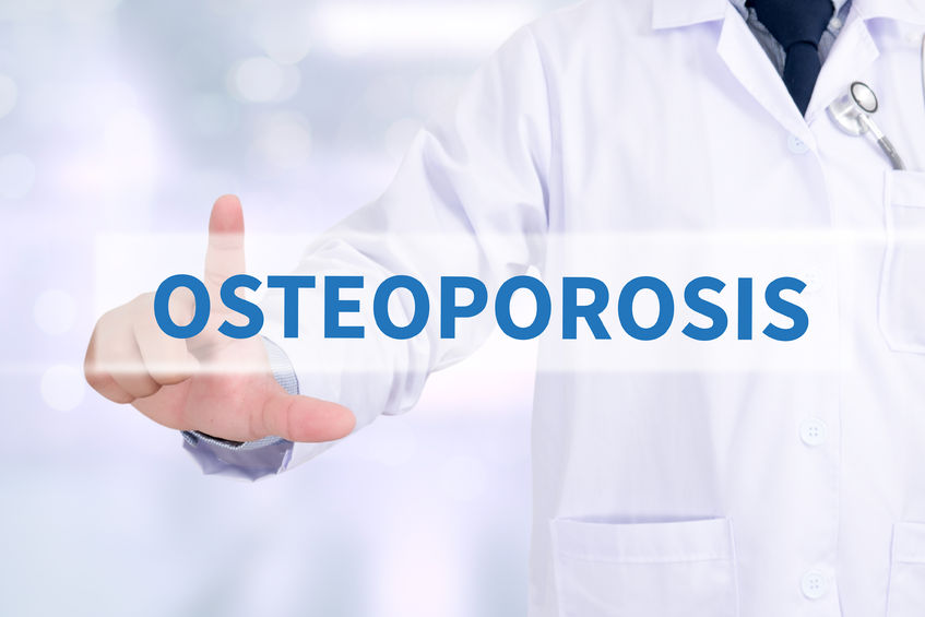 You Might Have Osteoporosis