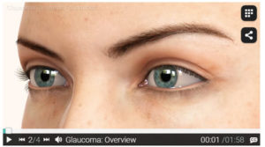 Glaucoma-Overview-Video