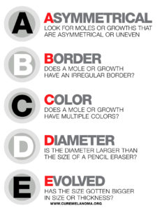 skin cancer ABCs of prevetion
