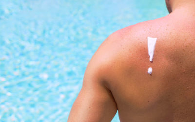 When to Screen for Skin Cancer