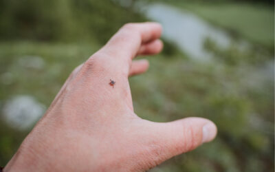 What to Do About Tick Bites